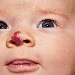 Kora's nose