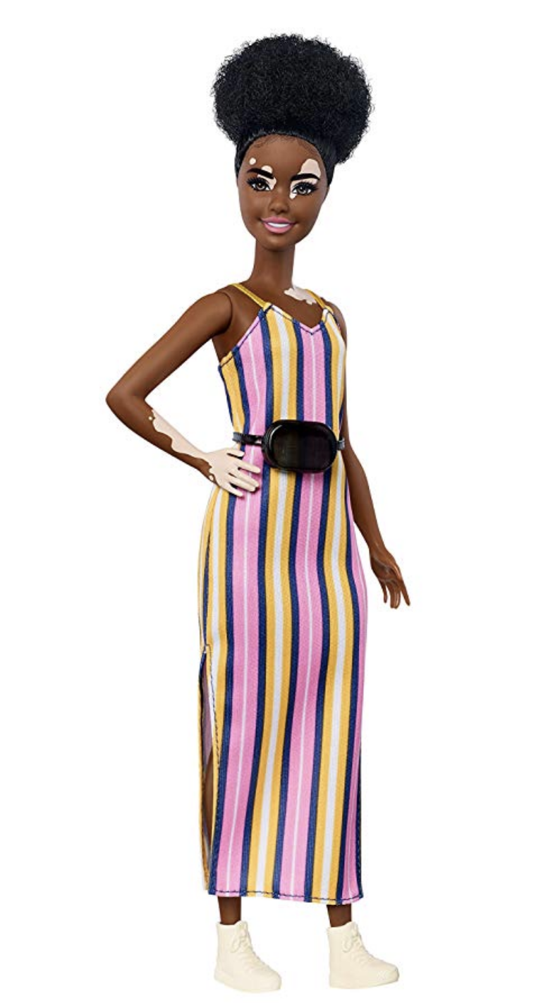 Barbie Released A New Doll With A Skin Condition Called 'Vitiligo' Kids